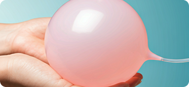 Bariatric Balloon