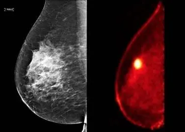 Digital PET-CT